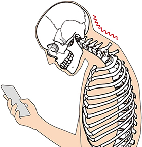 首下がり症候群の原因