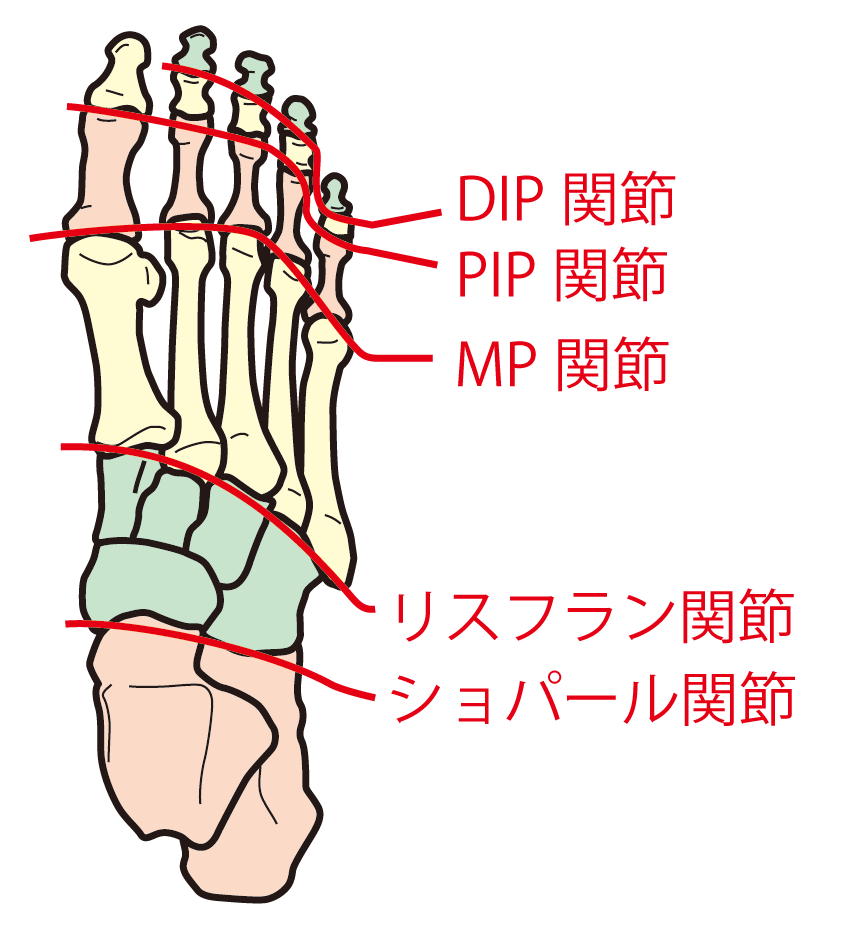 リスフラン関節