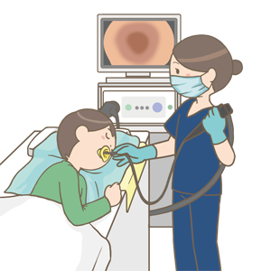 上部消化管内視鏡（胃カメラ）