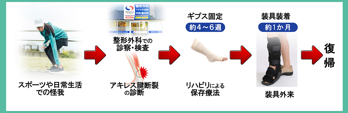 アキレス腱断裂